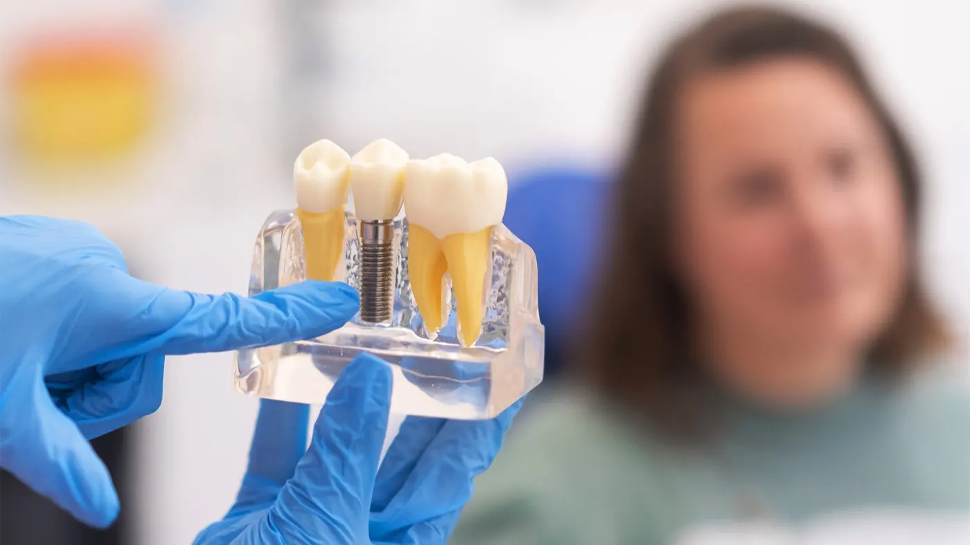 Wisdom tooth extraction: when it is needed and how recovery goes